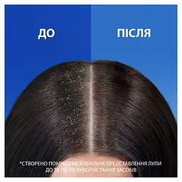 Шампунь Head & Shoulders Свіжість ментолу Проти лупи 400 мл (5011321336094) - мініатюра 4