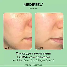Пінка для вмивання Medi-Peel Green Cica Collagen Clear 2.0 з Cica комплексом 300 мл - мініатюра 4