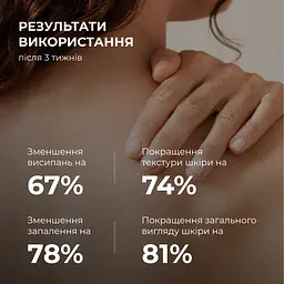 Сыворотка для проблемной кожи с салициловой кислотой Back & Body Acne Control serum Hillary 50 мл - миниатюра 8