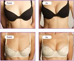 Гель для бюста Shs Perfect Bust, 150 мл - мініатюра 3