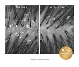 Очищувальний скраб для шкіри голови Moroccanoil Purifying Scrub - мініатюра 4