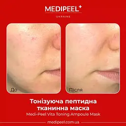 Тканинна маска для обличчя Medi-Peel Vita Toning Ampoule Mask тонізувальна ампульна 30 мл - мініатюра 3