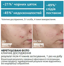 Ультраконцентрована сироватка La Roche-Posay Effaclar з ефектом пілінгу для жирної проблемної шкіри 30 мл - мініатюра 9