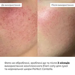 Комплексный бьюти-сет Perfect Centella Deep Hydration Hillary для сухой и нормальной кожи - миниатюра 4