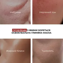 Комплекс Hillary глиняних масок для детоксикації та зменшення набряків - мініатюра 12