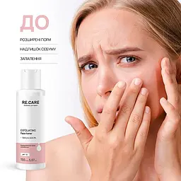 Відлущувальний тонер для обличчя Re.Care Exfoliating Face Toner 150 мл - мініатюра 3