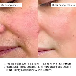 Комплекс Hillary для зменшення набряків та відновлення мікроциркуляції шкіри - мініатюра 13