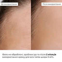 Весняний догляд для нормального типу шкіри Hillary - мініатюра 17