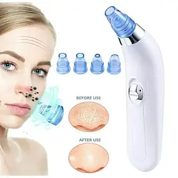 Вакуумний очисник Derma suction DS Vacuum для професійної чистки шкіри та пор обличчя - мініатюра 5