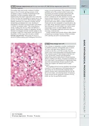 Wheater's Basic Pathology: A Text, Atlas, and Review of Histopathology. International Edition, 5th Edition - мініатюра 10