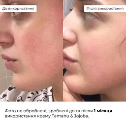 Весняний догляд для жирного типу шкіри Hillary - мініатюра 12