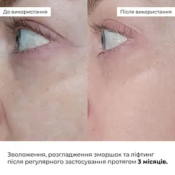 Антивіковий базовий догляд для обличчя Hillary - мініатюра 2