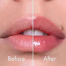 Інтенсивний плампер для губ VT Cosmetics Reedle Shot Lip Plumper Expert 4.3 г (VTC061) - мініатюра 4