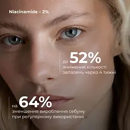 Комплексний б’юті-сет Perfect Niacinamide Sebo Balance Hillary для жирної та комбінованої шкіри - мініатюра 8