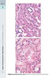 Wheater's Basic Pathology: A Text, Atlas, and Review of Histopathology. International Edition, 5th Edition - мініатюра 9