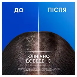 Шампунь проти лупи Head & Shoulders Свіжа м'ята 2-в-1, 400 мл - мініатюра 4