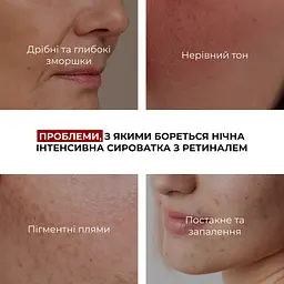 Комплекс Hillary для нічного оновлення та денного захисту шкіри - мініатюра 3