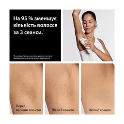 Фотоепілятор Braun PL5412 - мініатюра 3