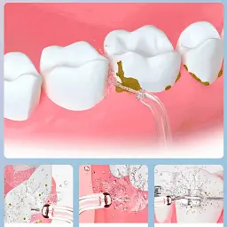 Іригатор Enpuly Oral Irrigator ML8 [63128] - мініатюра 4