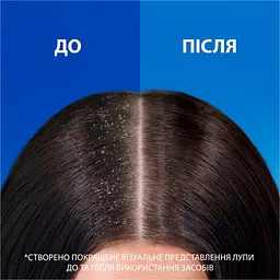 Шампунь проти лупи Head & Shoulders Проти випадіння волосся 400 мл - мініатюра 8