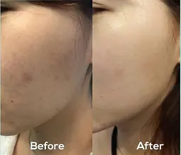 Сироватка для обличчя AXIS-Y Dark Spot Correcting Glow Serum Sample, 1.5ml - мініатюра 4
