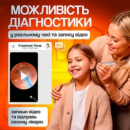 Пристрій для видалення вушної сірки з камерою Brillix 1296P Білий (PO-White) - мініатюра 3