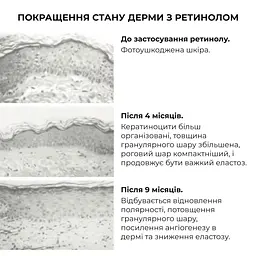 Комплекс нічного відновлення шкіри обличчя з ретинолом та пептидами ReNuAge Nighttime Skin Renewal Complex with Retinol and Peptides Hillary - мініатюра 8