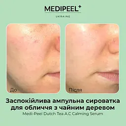 Сироватка ампульна для обличчя Medi-Peel Dutch Tea AC Calming Serum з чайним деревом 70 мл - мініатюра 4