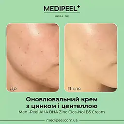 Крем для обличчя Medi Peel AHA BHA Zinc Cica-Nol B5 Cream оновлювальний з цинком і центеллою 30 мл - мініатюра 2