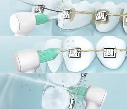Іригатор Panasonic EW1313G DentaCare [69900] - мініатюра 4
