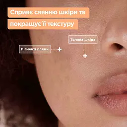 Очищувальний гель Mixa проти тьмяності шкіри обличчя 150 мл - мініатюра 4