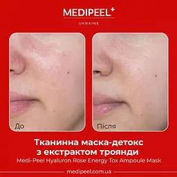 Тканинна маска-детокс Medi-Peel Rose Diamond Radiant Glow Mask зволожувальна з екстрактом троянди 25 мл - мініатюра 3