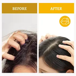 SH-RD Truffle Moisturizing Shampoo професійний зволожуючий шампунь на основі трюфеля, 200 мл - мініатюра 6