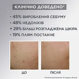 Зволожувальний крем Garnier Pure Active для надання матовості шкіри обличчя 50 мл - мініатюра 8
