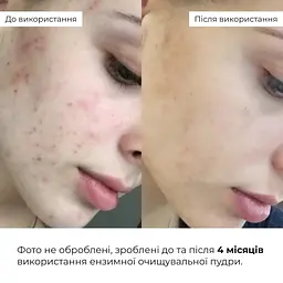 Ензимна очищувальна пудра Hillary Enzyme Probio Cleanser Powder для нормальної сухої та чутливої шкіри 40 г - мініатюра 9