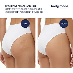 Бандажне обгортання з антицелюлітним ефектом охолоджувальне BodyMade 150 мл х 2 бинти - мініатюра 6