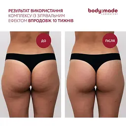 Бандажне обгортання з антицелюлітним ефектом зігрівальне BodyMade 150 мл х 2 бинти - мініатюра 6