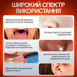 Пристрій для видалення вушної сірки з камерою Brillix 1296P Чорний (PO-Black) - мініатюра 4