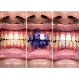 Засіб для відбілювання зубів SmileKit V34 Коректор кольору зубів 30 мл (5.3010) - мініатюра 9
