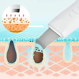 Ультразвуковий скрабер для очищення обличчя Skin Tech Scrubber 3305 Білий (3305O) - мініатюра 5