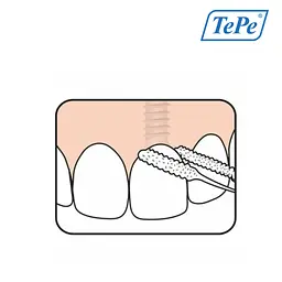 Зубна нитка TePe Bridge & Implant (суперфлос), 30 шт - мініатюра 6