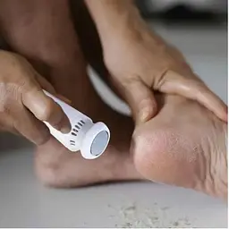 Пемза електрична FOOT GRINDER 928-3Dля ніг та п'ят з насадками - мініатюра 2
