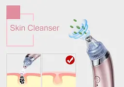 Вакуумний апарат для чищення пор обличчя Menqshahayd XN-8030 Pink (kz048-hbr) - мініатюра 3