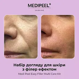 Ліфтинг-набір з ефектом філера MediPeel Eazy Filler Multi Care Kit 4 засоби - мініатюра 6