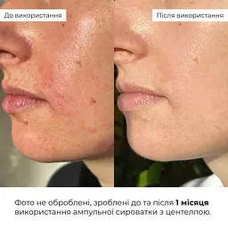 Ампульна сироватка з центелою Hillary Ampoule Centella Serum 30 мл - мініатюра 11