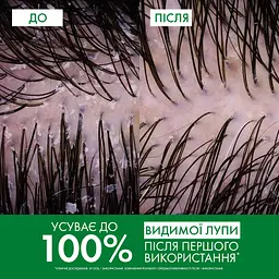 Шампунь Vichy Dercos проти лупи для жирного волосся та подразненої шкіри голови 200 мл (M0363621) - мініатюра 6