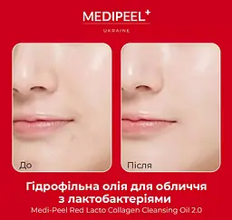 Гідрофільна олія для обличчя Medi-Peel Red Lacto Collagen Cleansing Oil з лактобактеріями 200 мл - мініатюра 6