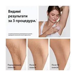 Фотоепілятор Braun PL1111 + GIL Venus - мініатюра 3