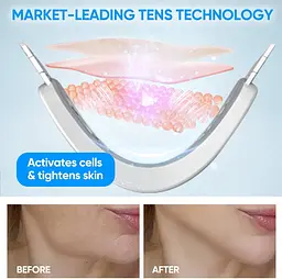 Електричний масажер V-Face FaceLift для обличчя з блакитним світлом - мініатюра 7