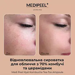 Сироватка для обличчя Medi-Peel Hyal Kombucha Tea-Tox Ampoule відновлювальна з 70% комбучі 50 мл - мініатюра 4